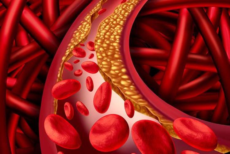 5 Buah Penurun Kolesterol Tinggi yang Perlu Dikonsumsi Secara Rutin